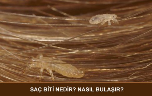 Bebegimin Saci Neden Dokuluyor Anneler Kadinlar Kulubu